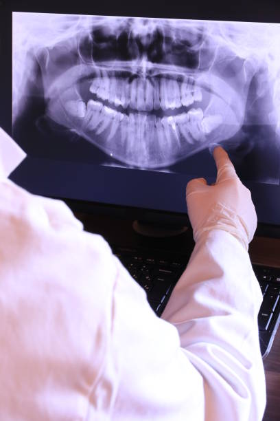 Best Emergency Tooth Extraction in Amity, OR