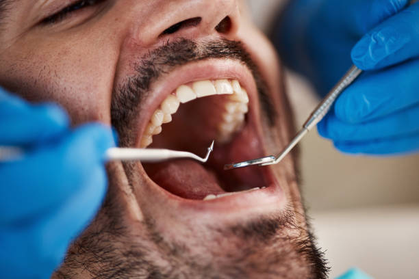 Best Emergency Treatment for Toothache in Amity, OR